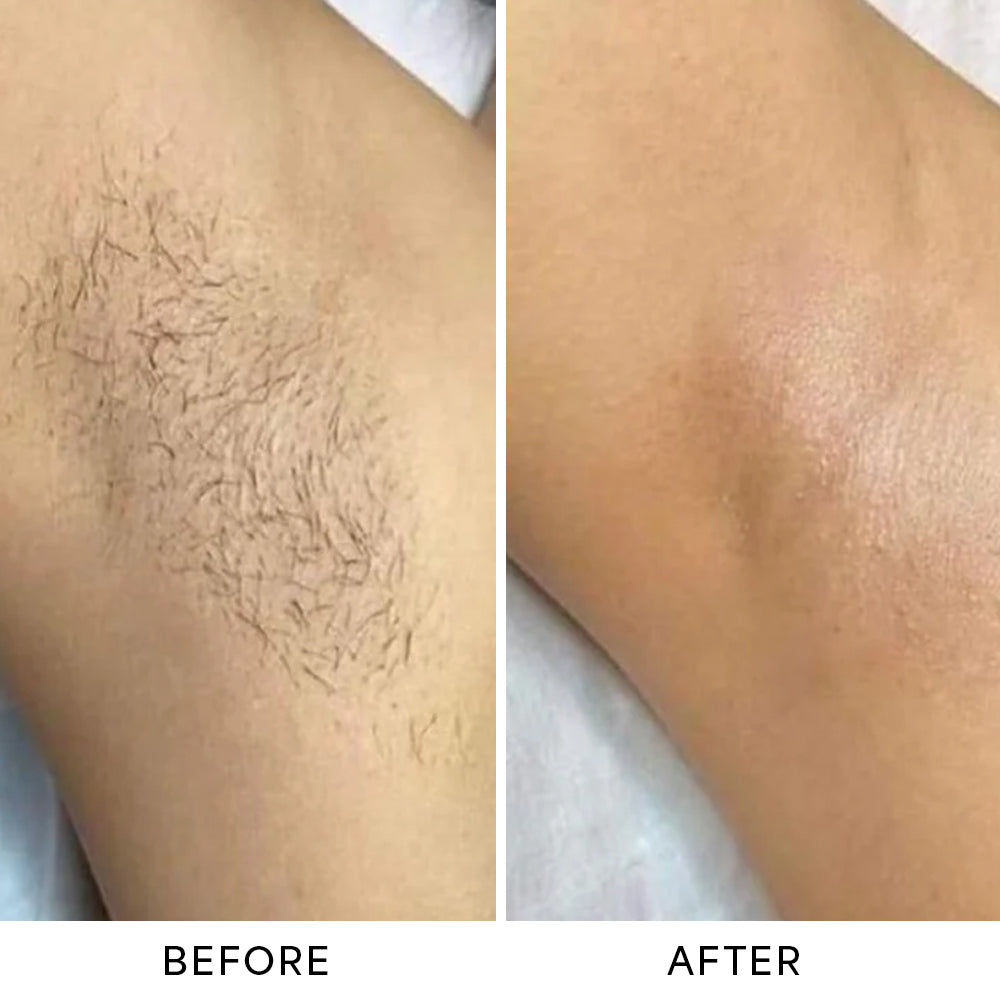 CamZone™ Trimmer 2.0