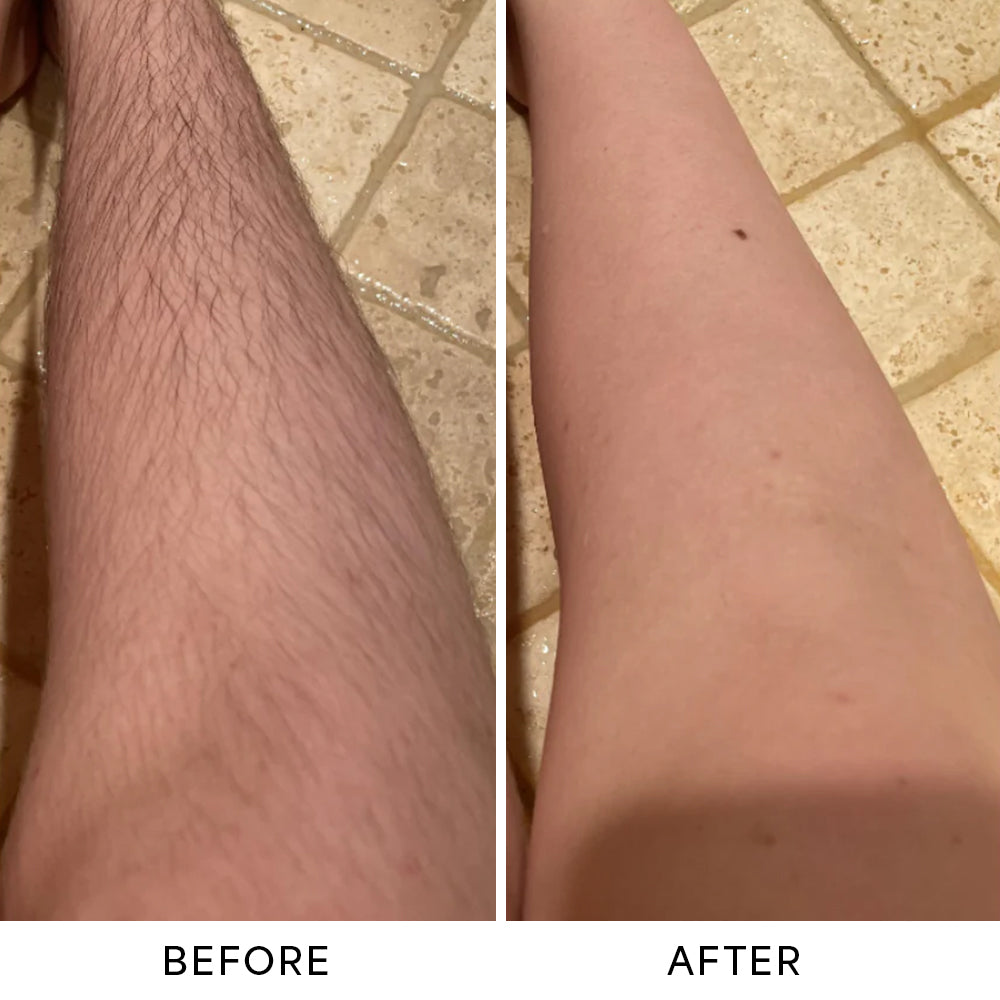 CamZone™ Trimmer 2.0