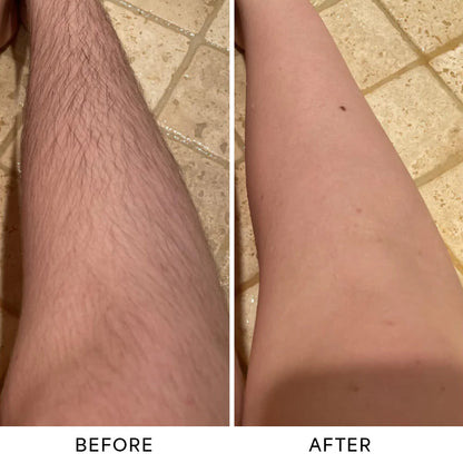 CamZone™ Trimmer 2.0